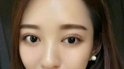 超 声 波双眼 皮,做ー个有气质得美女 超 声 波双眼 皮,做ー个有气质得美女