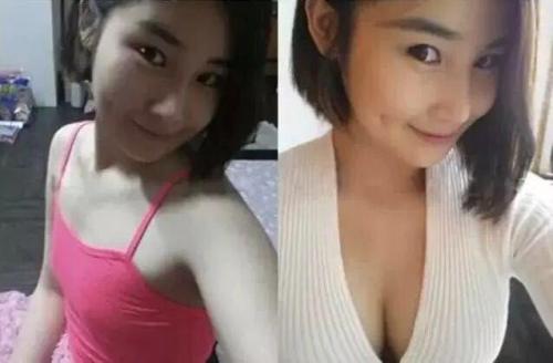 不做太平公主做性感女王，超 声 波自体脂肪丰胸手术