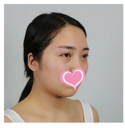 超 声 波瘦脸拒绝做老公得姐姐 超 声 波瘦脸拒绝做老公得姐姐