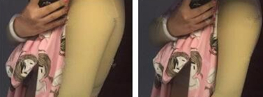 超声波减肥瘦手臂的效果如何呢?331 超声波减肥瘦手臂的效果如何呢?331