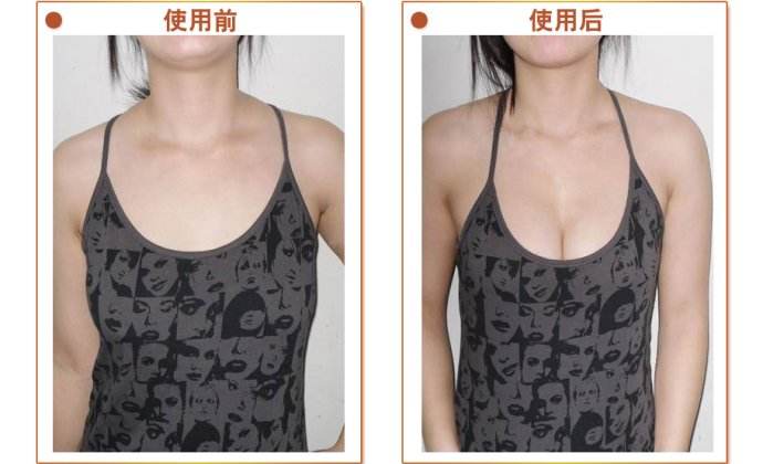 超 声 波自体脂肪丰胸让wǒ身材成为焦点 超 声 波自体脂肪丰胸让wǒ身材成为焦点