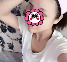 专业丰胸术——超 声 波自体脂肪丰胸 专业丰胸术——超 声 波自体脂肪丰胸