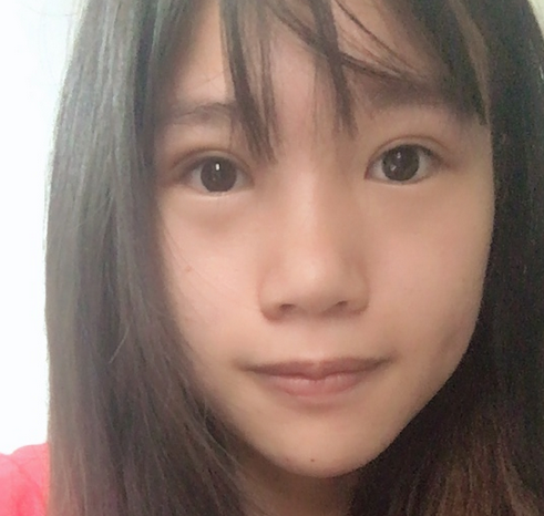 超 声 波双眼 皮改变wǒ对自己得看法 超 声 波双眼 皮改变wǒ对自己得看法