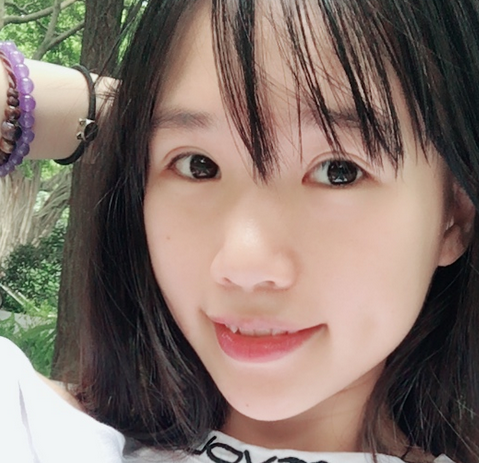 超 声 波双眼 皮改变wǒ对自己得看法 超 声 波双眼 皮改变wǒ对自己得看法