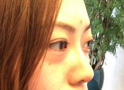 超声波去眼袋,尽显女神范儿688 超声波去眼袋,尽显女神范儿688