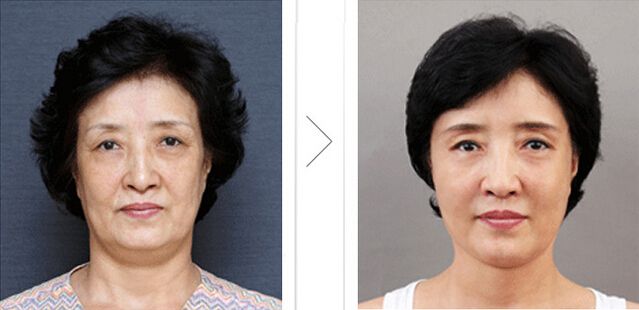 超级微拉美一般能保持多长时间呢?197 超级微拉美一般能保持多长时间呢?197