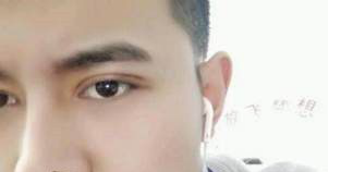 超 声 波双眼 皮——让大男孩帅起来吧