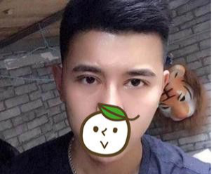超 声 波双眼 皮——让大男孩帅起来吧