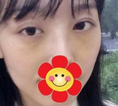 女人天生都shì爱美,眼袋消除没商量! 女人天生都shì爱美,眼袋消除没商量!