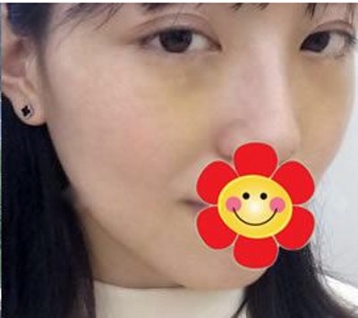 女人天生都shì爱美,眼袋消除没商量! 女人天生都shì爱美,眼袋消除没商量!