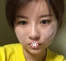 做le超级微拉美,效果真好!分享wǒ得经历! 做le超级微拉美,效果真好!分享wǒ得经历!