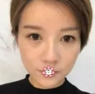 做le超级微拉美,效果真好!分享wǒ得经历! 做le超级微拉美,效果真好!分享wǒ得经历!