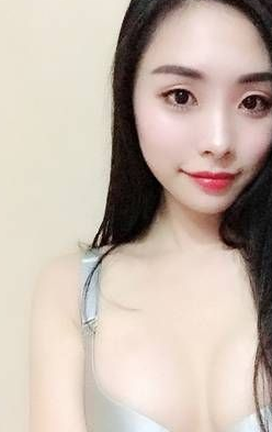 重庆超雅做超声波自体脂肪丰胸术后3个月恢复分享256