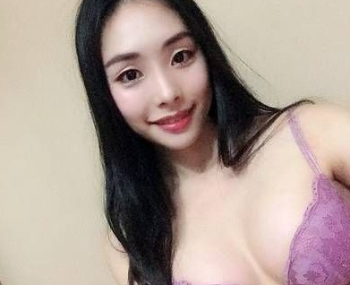重庆超雅做超声波自体脂肪丰胸术后3个月恢复分享256