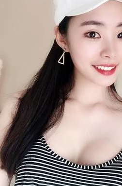 重庆超雅做超声波自体脂肪丰胸术后3个月恢复分享256