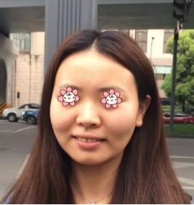 超 声 波瘦脸给你减龄何止十岁? 超 声 波瘦脸给你减龄何止十岁?