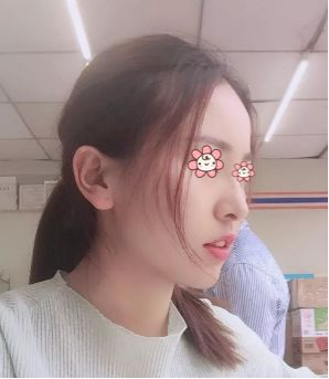 超 声 波瘦脸给你减龄何止十岁? 超 声 波瘦脸给你减龄何止十岁?
