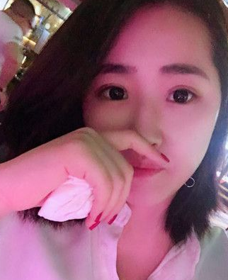 超声波双眼皮案例:为了美我愿意再勇敢一次980 超声波双眼皮案例:为了美我愿意再勇敢一次980