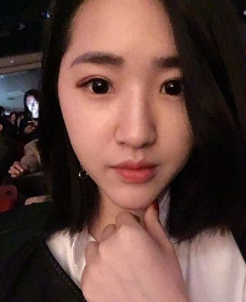 超声波双眼皮案例:为了美我愿意再勇敢一次980 超声波双眼皮案例:为了美我愿意再勇敢一次980