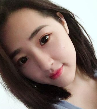 超声波双眼皮案例:为了美我愿意再勇敢一次980 超声波双眼皮案例:为了美我愿意再勇敢一次980
