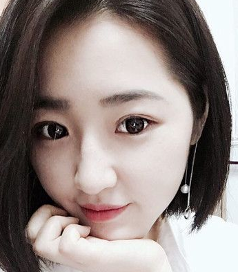 超声波双眼皮案例:为了美我愿意再勇敢一次980 超声波双眼皮案例:为了美我愿意再勇敢一次980