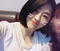 超声波双眼皮案例:为了美我愿意再勇敢一次980 超声波双眼皮案例:为了美我愿意再勇敢一次980