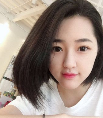 超声波双眼皮案例:为了美我愿意再勇敢一次980 超声波双眼皮案例:为了美我愿意再勇敢一次980