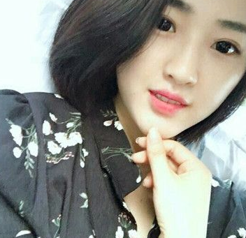 超声波双眼皮案例:为了美我愿意再勇敢一次980 超声波双眼皮案例:为了美我愿意再勇敢一次980