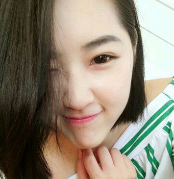 超声波双眼皮案例:为了美我愿意再勇敢一次980 超声波双眼皮案例:为了美我愿意再勇敢一次980