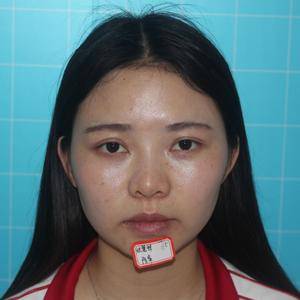 超雅专业超声波瘦脸手术,解决瘦脸的绝佳方案790 超雅专业超声波瘦脸手术,解决瘦脸的绝佳方案790