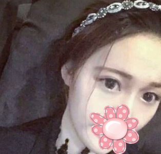 遗传性眼袋消除方法——超声波去眼袋196 遗传性眼袋消除方法——超声波去眼袋196