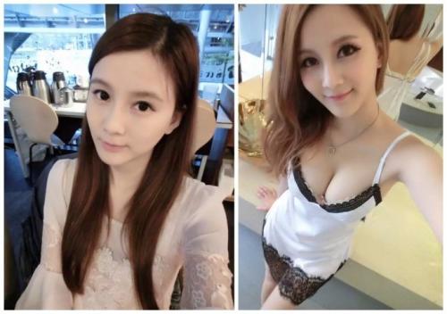 性感身材夺目吸睛,超 声 波自体脂肪丰胸手术 性感身材夺目吸睛,超 声 波自体脂肪丰胸手术