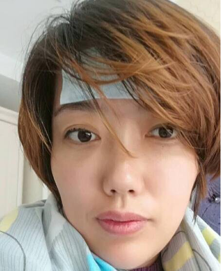 快来看超声波去眼袋是如何治愈我的三观618 快来看超声波去眼袋是如何治愈我的三观618