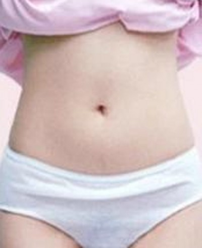 超声波减肥,让我改头换面428 超声波减肥,让我改头换面428
