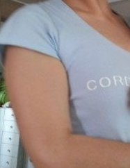 超 声 波减肥瘦手臂感觉如何? 超 声 波减肥瘦手臂感觉如何?