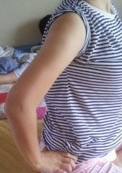 超 声 波减肥瘦手臂感觉如何? 超 声 波减肥瘦手臂感觉如何?