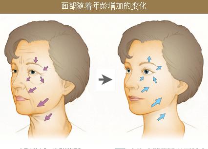 超级微拉美紧致肌肤的效果不错哦!659 超级微拉美紧致肌肤的效果不错哦!659