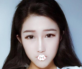 超声 波瘦脸