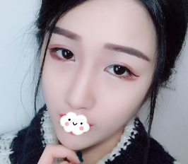 超声 波瘦脸