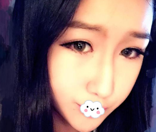 超声 波瘦脸