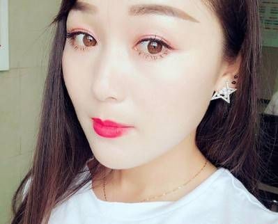 超声波双眼皮。让自己美美哒370 超声波双眼皮。让自己美美哒370