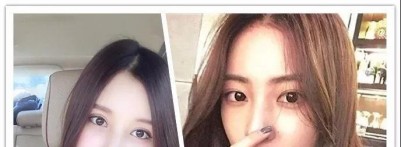 只有网红才可以做双眼皮吗？普通人需要吗？