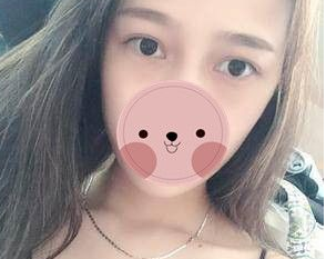国庆去哪里嗨皮？wǒ去重庆超雅做超 声 波去眼袋啦~