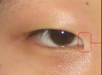 国庆节还没到,我妈帮我约了超声波双眼皮~108 国庆节还没到,我妈帮我约了超声波双眼皮~108