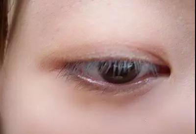 国庆节还没到,我妈帮我约了超声波双眼皮~108 国庆节还没到,我妈帮我约了超声波双眼皮~108
