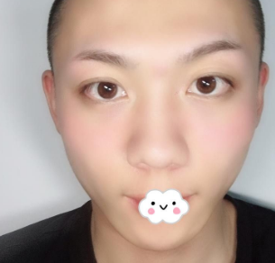 时尚型男做不开刀下巴延长术后更潮le 时尚型男做不开刀下巴延长术后更潮le