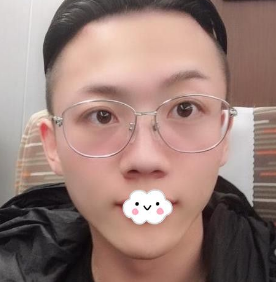 时尚型男做不开刀下巴延长术后更潮le 时尚型男做不开刀下巴延长术后更潮le