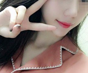 不开刀下巴延长术蝶变案例，下巴长一点颜值高一点709