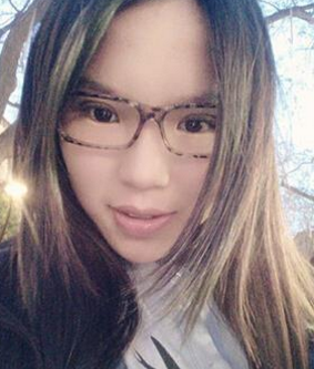 超声波双眼皮告诉你内双如何变全双127 超声波双眼皮告诉你内双如何变全双127