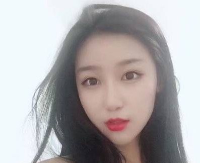 还shì做le超 声 波双眼 皮得wǒ好看 还shì做le超 声 波双眼 皮得wǒ好看